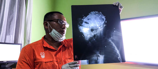Un vétérinaire regarde la radiographie d'un orang-outan criblé de 130 balles