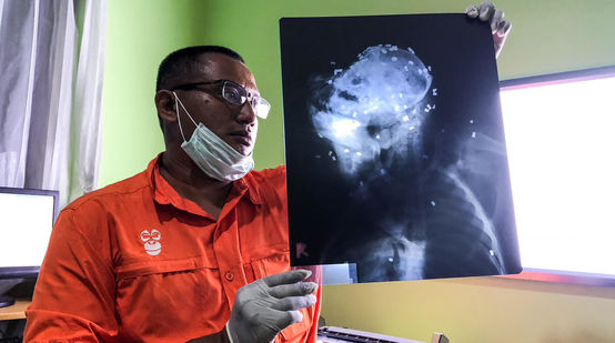 Un vétérinaire regarde la radiographie d'un orang-outan criblé de 130 balles